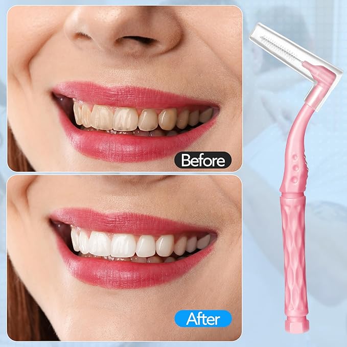 230 PCS Braces Brush, interdental Brushes Between Teeth Soft Dental Floss Picks Toothpicks Dental Brush Braces Flossers for Braces Cleaning Kit Tooth Cleaner Tool with case(Bright Colors)