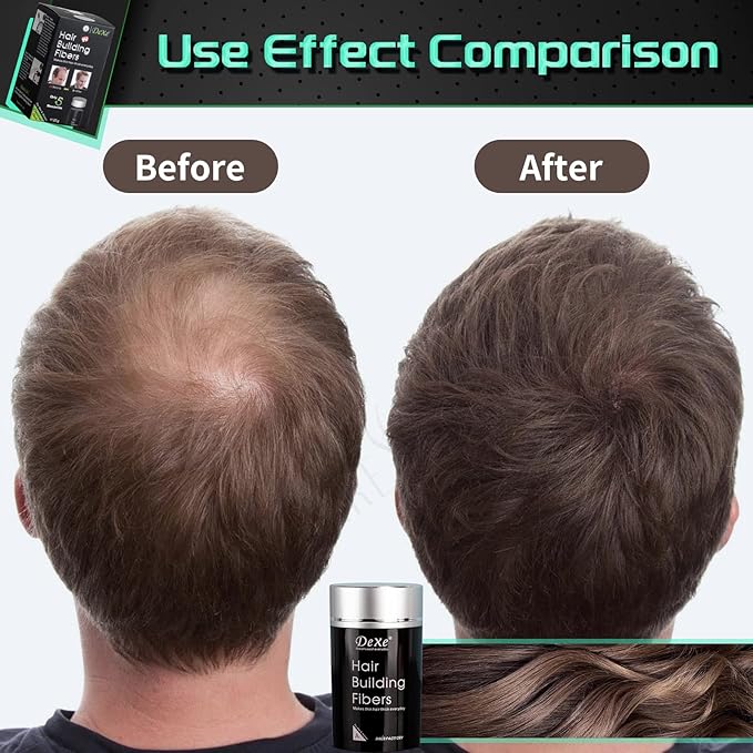 Hair Fibers for Thinning Hair (Medium Brown) - Hair Thickener for Fine Hair for Women & Men - Conceals Hair Loss in 15 Sec - 22gr Bottle