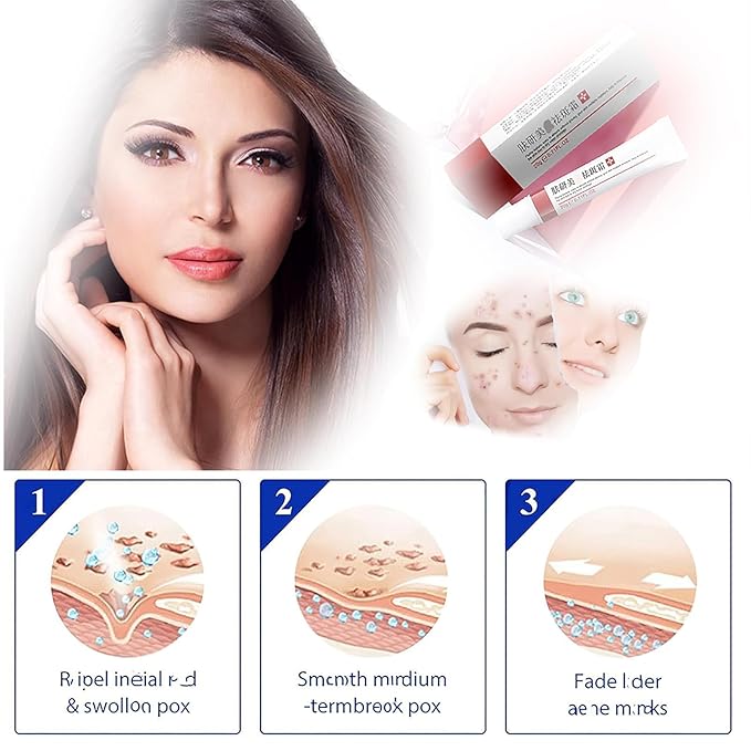 Generic Crema para Manchas Oscuras en La Cara, Dark Spot Remover for Face, Freckles Melasma Brown Spot Corrector for Men Women, Crema para Las Manchas de La Cara 20G