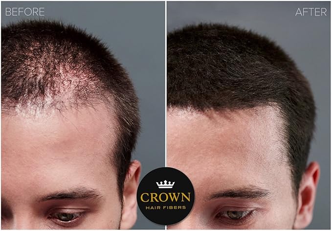 CROWN Hair Building Fibers (28g) - Instantly Cover Fine & Thinning Hair for a Thicker, Fuller Look - A Natural Keratin Concealer - 13 Shades for Men & Women - Dark Brown