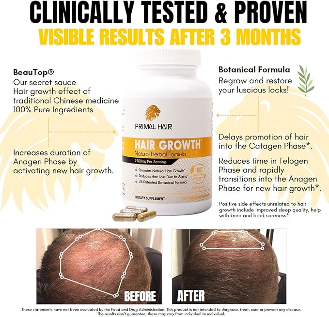 100% Natural Growth Treatment, Reduces Hair Loss, US Patented Formula Proven Effective for Men & Women, 100% Vegan Ingredients, Non-GMO, 30-Day Supply