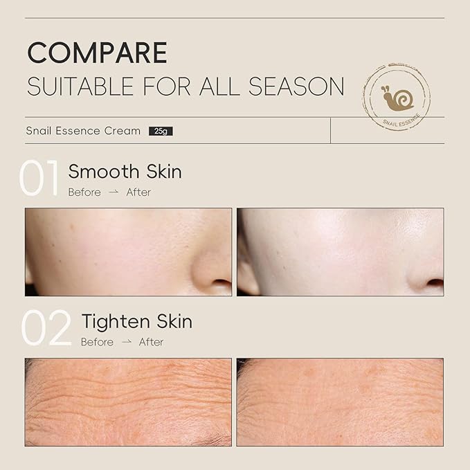 AKARY Snail Essence Face Cream Moisturizing Acne Scar Removal Cream, Soften, Improve Nourishing Collagen Essence Korean Face Moisturizer for Damaged Skin, Day & Night Repairing