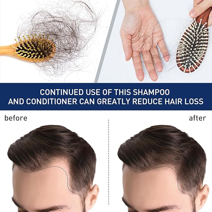 20g Hair Growth Cream for Thinning Hair – Stimulates Follicles, Reduces Hair Loss & Boosts Regrowth for Men and Women – Natural Scalp Treatment for Bald Spots & Receding Hairline