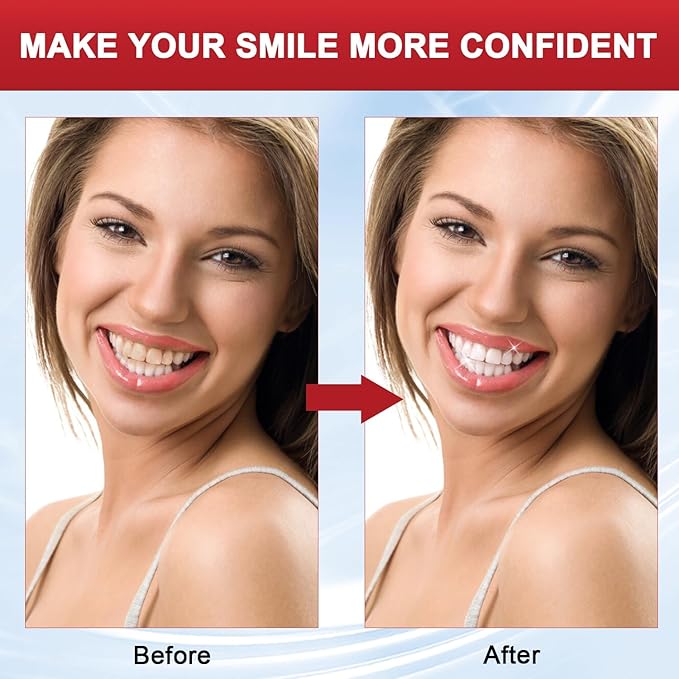 SP-8 Probiotic Toothpaste, SP8 Toothpaste Fresh Breath, Deep Cleaning Care (01)
