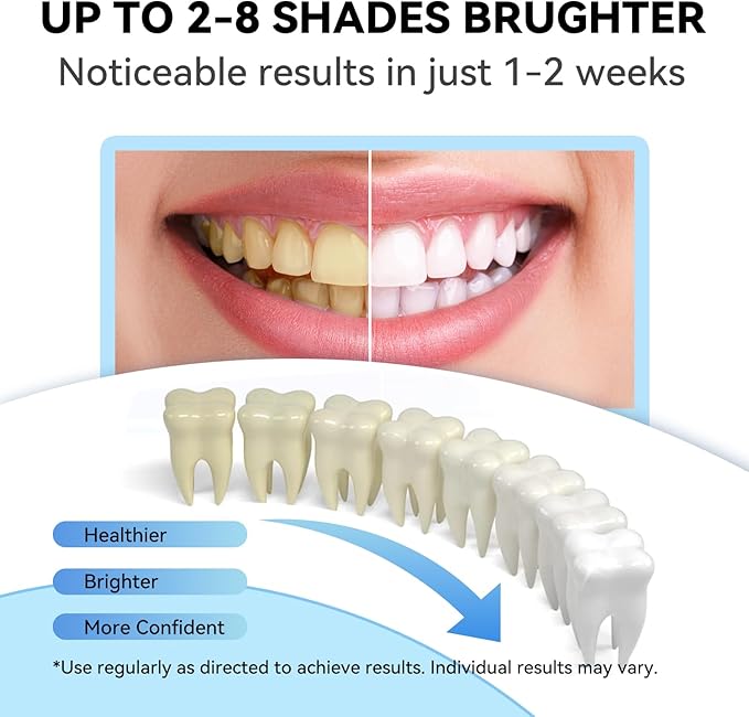 JTF Teeth Whitening Gel Kit: 35% Carbamide Peroxide Removes Stains from Coffee, Wine & Smoking, Safe for Sensitive Teeth & Gentle on Enamel - with 5 Whitening Gels and 1 Remineralization Gel, Mint