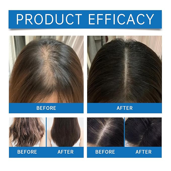 30ml Rosemary Hair Growth Serum Roller - Hair Regrowth Treatment for Thicker & Stronger Hair, Anti-Hair Loss Scalp Care Essence with Ginger & Vitamin E