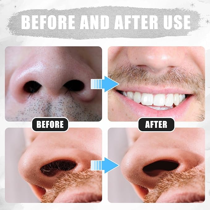 12pcs 2 in 1 Nasal Hair Cutter, 360 Rotating Nose Hair Trimmer for Men Women Double Sided Nose Hair Cleaner with Ear Picker Portable Manual Nostril Hair Removal Tool (Black)