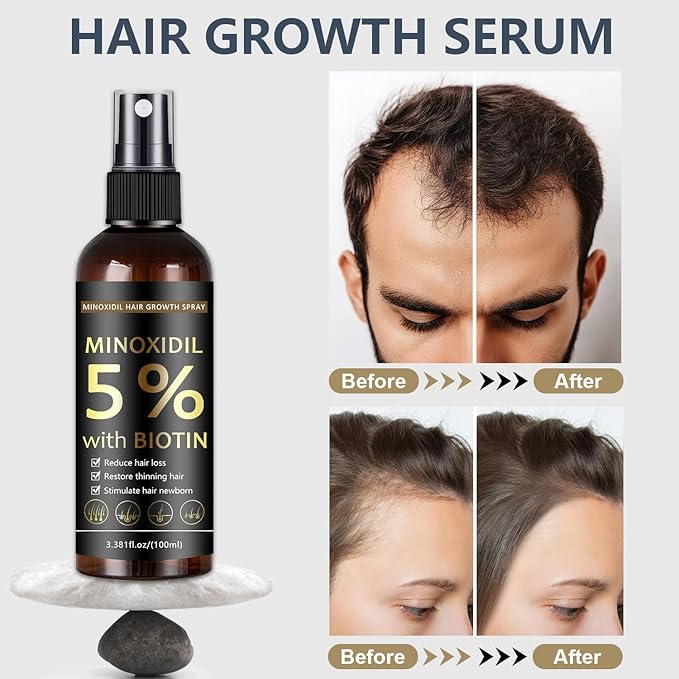 5% Minoxidil Hair & Beard Growth Spray with Biotin for Men & Women, Hair Regrowth, Treatment for Hair Loss & Thinning, for Stronger Thicker Fuller Healthier Hair, for All Hair Types (3.38 oz, Black)