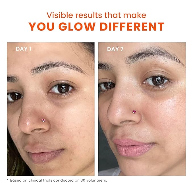 Fox.tale SPF 70 PA++++ Dewy Finish Sunscreen with Niacinamide | Lightweight, Non-Greasy, No White Cast | Broad Spectrum Sun Protection | For All Skin Types | 50 mL