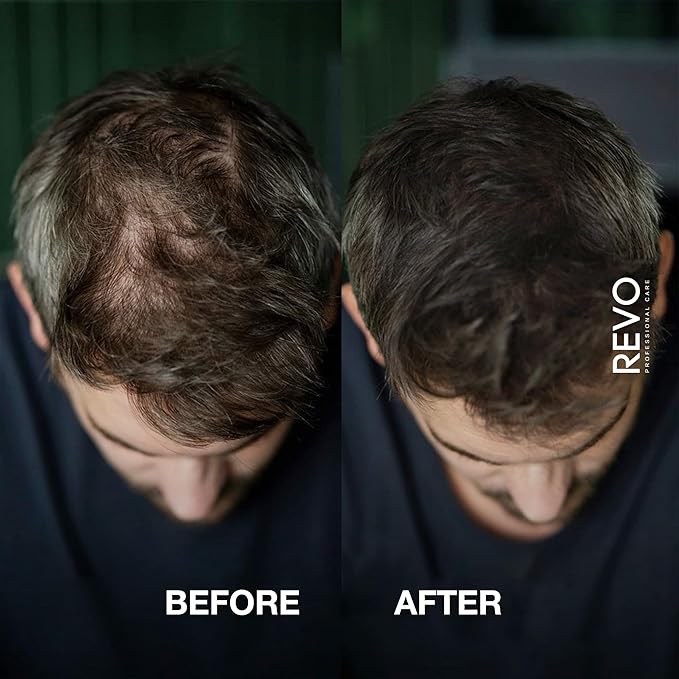 REVO Hair Building Fibers Kit for Thinning Hair (25g) with Fiberhold Spray (100ml) – 3-Pc Professional Set, Natural Plant-Based Hair Thickener & Concealer for Men & Women - DARK BROWN