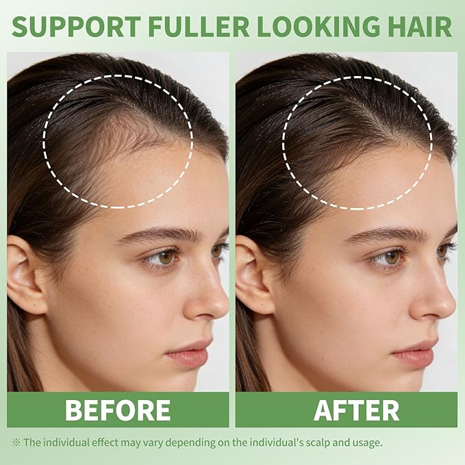 Rosemary Oil for Hair Growth Serum Roll On with 3% Rosemary, Hydrating & Non-Greasy Scalp Serum for Thicker-Looking Hair, Daily Care Massage Roller Applicator for Men & Women, 25ml