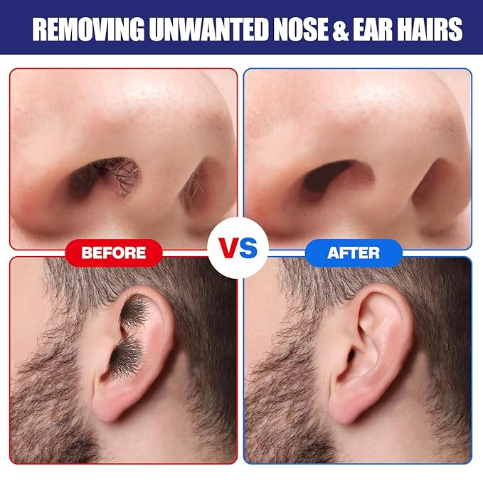 Nose Wax Kit, 120 g Wax, 30 Applicators,Nostril and Ears Hair Removal Kit for Men & Women,Includes 15 Balm Wipes and Mustache Guards etc. Lasts up to 6 Weeks