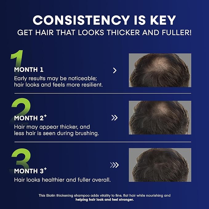 Svvimer Biotin Hair Growth Shampoo - Root Activator Thickening Shampoo for Men - With Rosemary Tea Tree Oil Caffeine For Hair Loss And Thinning Thickening - 13.5 Fl Oz (Pack Of 1)