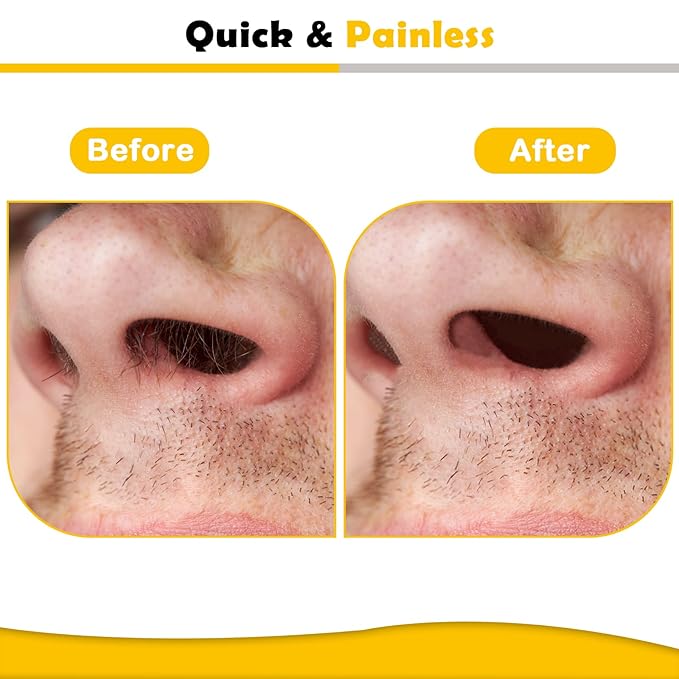 120g Wax Nose Wax Kit, Nose Hair Wax Kit with 40 Applicators, Quick & Painless Nose Waxing Kit for Men and Women, Nose Hair Remover Kits Used 20 Times Usage