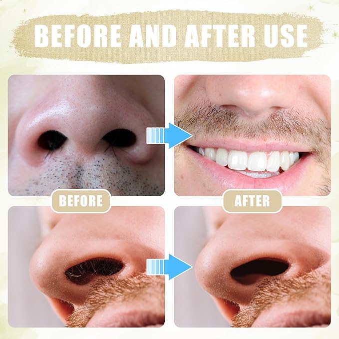 12pcs 2 in 1 Nasal Hair Cutter, 360 Rotating Nose Hair Trimmer for Men Women Double Sided Nose Hair Cleaner with Ear Picker Portable Manual Nostril Hair Removal Tool (White)