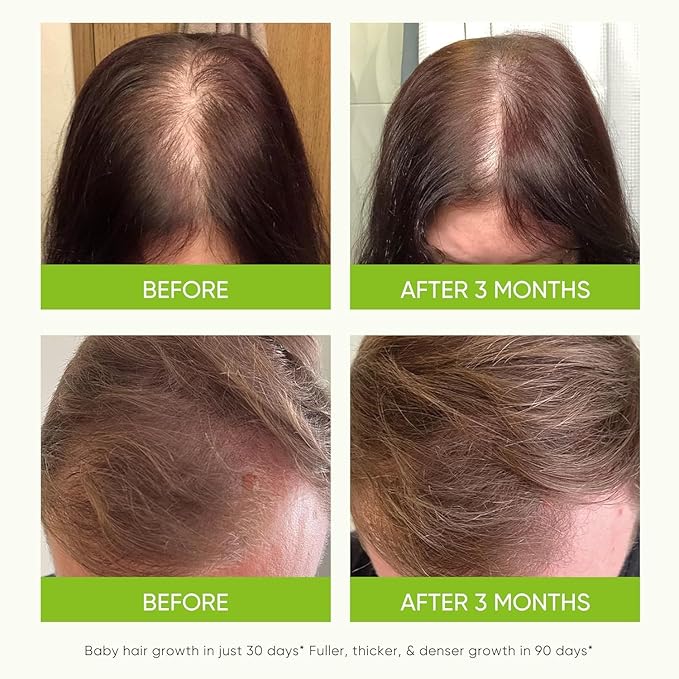 Svvimer Rosemary Shampoo and Conditioner Plus Hair Boost Spray Set - Hair Volumizing Thickening Products - 3 Products