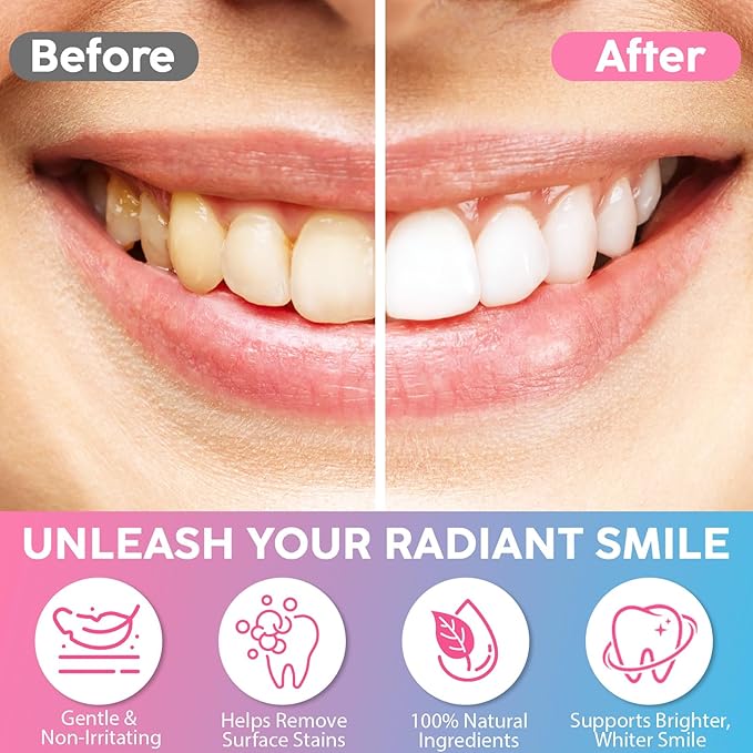 2 Pack Niacinamide Whitening Toothpaste for Radiant Smile – Gentle Stain Removal, Fresh Breath, Deep Cleaning & Gum Protection – Niacinamide Toothpaste for Daily Use – Lasting Mint Flavor – 3.5oz Tube