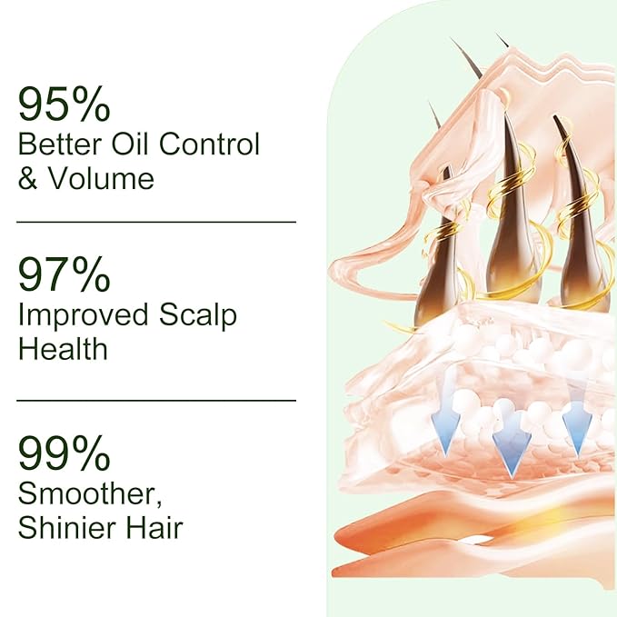 Tgideas Batana Oil & Rosemary Shampoo for Hair Growth, Formula for Thinning Hair & Reduce Hair Loss, Nourish Scalp & Add Volume, for Men & Women (Pack of 2)