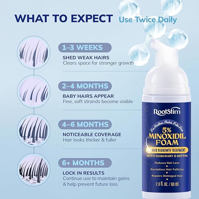 5% Minoxidil Foam for men and women, Extra Strength Hair Regrowth Treatment for Thinning Hair and Hair Loss, Hair Follicle Health – Thicker, Fuller Hair Growth Solution 6 FL.OZ