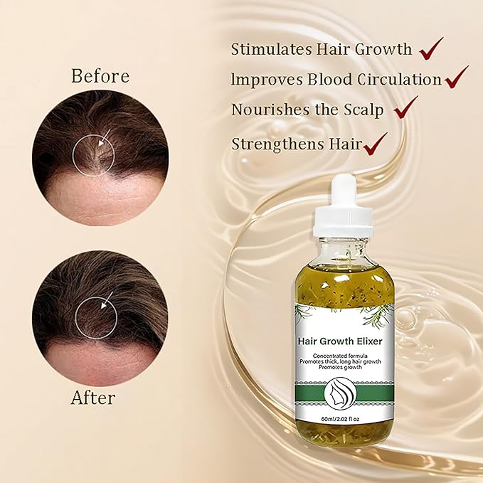 Hair Growth Serum with Rosemary Oil, Activates Follicles, Reduces Shedding & Strengthens Hair, Scalp Care Treatment for Healthier Looking Hair, 2.02 Fl Oz 2-Pack for Men & Women