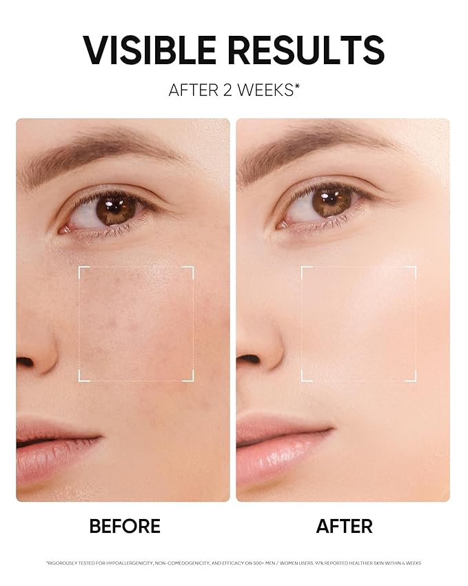Niacinamide Brightening Cream, Radiant Glow, Fade Dark Spots, Evens Skin Tone Moisturizer for Oil and Acne-prone Skin, Non-Sticky, 1fl.oz / 30g