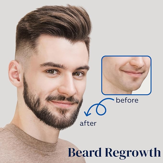 5% Minoxidil Spray for Men and Women, Minoxidil for Women Hair Growth, Minoxidil for Men Hair Growth Spray. (180ml)