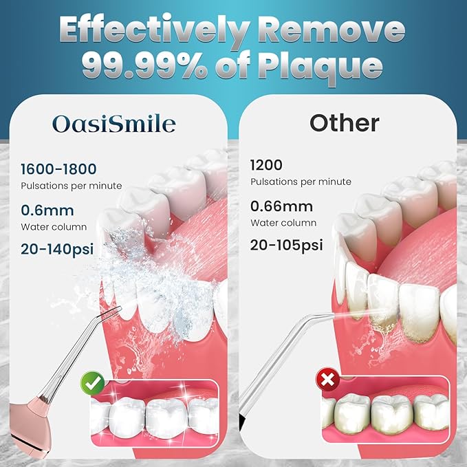 Water Flosser for Teeth Cleaning, 300ML Portable Cordless Oral Irrigator with DIY Strength, 4 Modes, IPX7 Waterproof & 30-Day Battery, 2-Min Smart Timer for Home/Travel Dental Care, Rose Gold