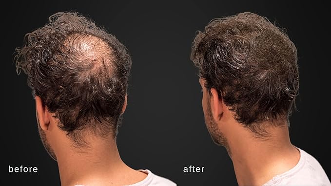 Hair Building Fibers - Volumizing Hair Fibers with real Keratin for Thinning Hair/Hair Loss Dermatologist Tested and Certified Hypoallergenic - 60 days + supply (Blond)