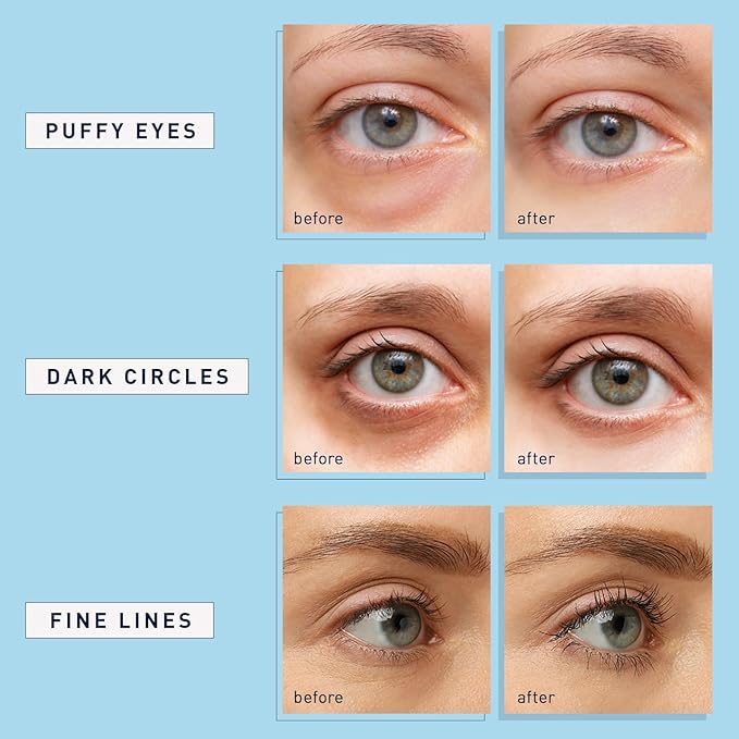 Enaskin Naturals Under Eye Patches for Dark Circles: 60 Pairs Retinol Collagen Eye Gels Mask - Reduce Wrinkles Puffy & Bags - Skin Treatment Pads - Anti Aging Moisturizer For Women (Blue 2 Pack)