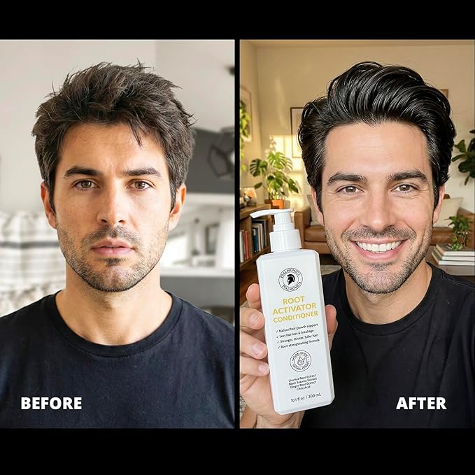 Root Activator Conditioner for Men - Natural Hair Growth Conditioner for Hair Loss and Thinning Hair - Hair Loss RegrowthTreatments for Women Men (300 ml (Pack of 1))