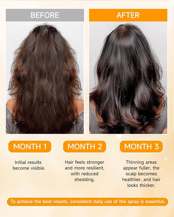 Hair Growth Spray, Hair Growth Oil Spray, with Biota Orientalis, Rosemary Oil & Biotin, Strengthens Hair Roots, Prevent Hair Thinning & Hair Loss, Thicker Fuller Hair for Women Men (2.02 Fl.oz)