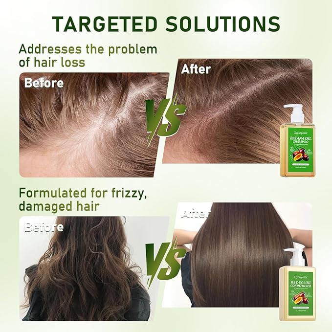 Batana Oil Shampoo and Conditioner, Hair loss and Batana Oil for Hair Growth Shampoo, Sulfate-Free for Both Men and Women 10.14 oz