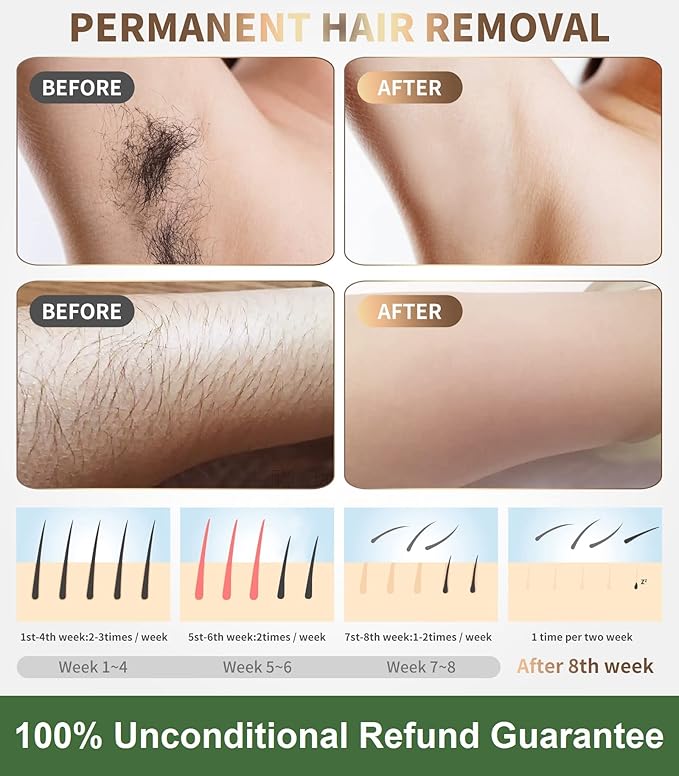 IPL Laser Hair Removal Device for Women & Men - at-Home Safe Painless Permanent Hair Reduction, 85% Hair Reduction in 4 Weeks, One-Button Control, Full Body & Face, Effective Salon Alternative