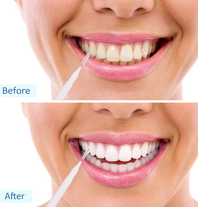 Patelai 100 Pieces Braces Brush for Cleaner Interdental Brush Toothpick Dental Tooth Flossing Head Oral Dental Hygiene Flosser Toothpick Cleaners Tooth Tool(White, Black, Pink,Proper Size)