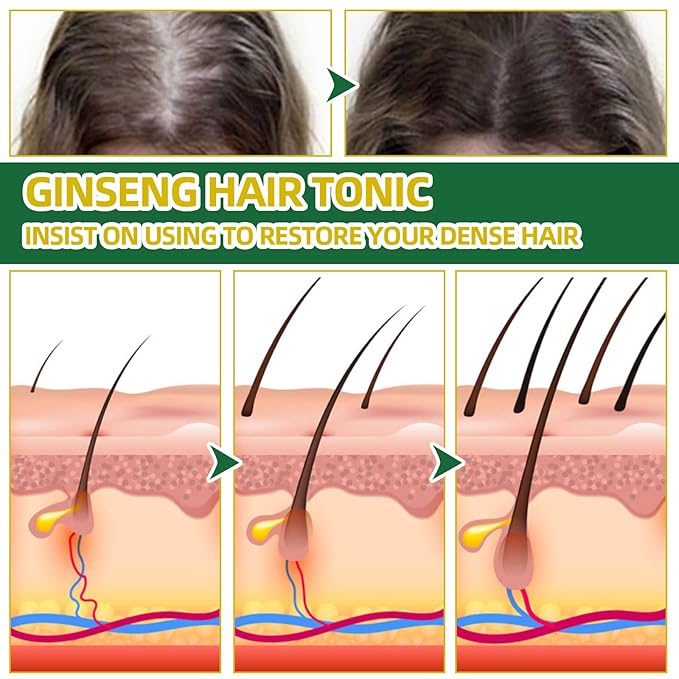 Natural Herbs Ginseng Hair Tonic, Organic Hair Growth Spray, Scalp Health Treatment, 100ml