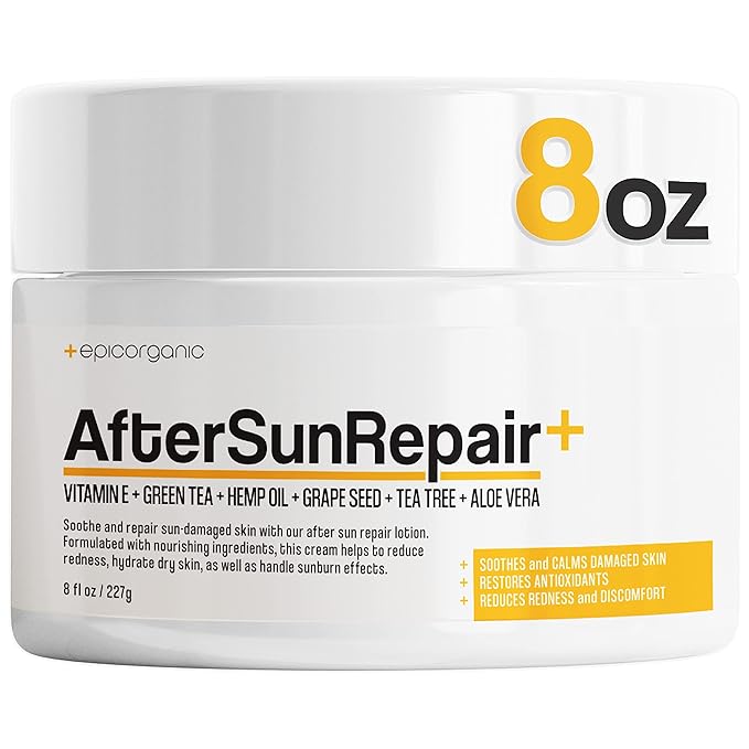 After Sun Lotion | Sunburn Relief | Aloe Vera & Vitamin E Cream | Body Lotion & Face Moisturizer | Lotion for Dry Skin | Itchy Skin Relief | Moisturizer Face Cream | 8 oz