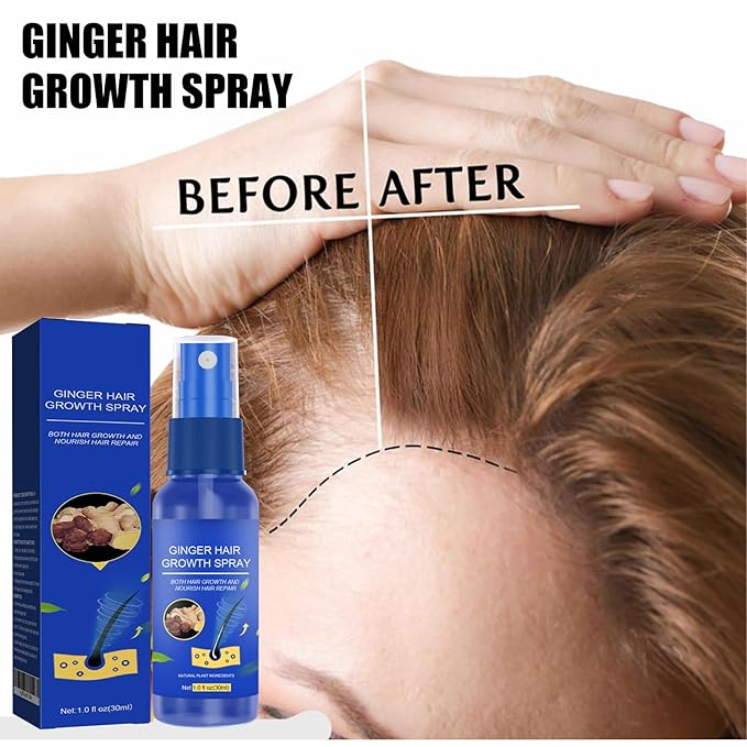 Ginger Hair Growth Spray for Men & Women, 30ml Anti-Hair Loss Treatment, Scalp Nourishing & Follicle Activation, Natural Ginger Extract for Thicker & Fuller Hair