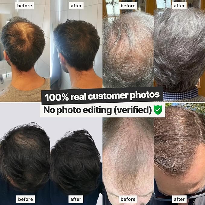 IMPERIO Hair Building Fibers for Thinning Hair - 26g Premium Hair Fibers for Women & Men in Hairdresser Quality - Hair thickening in less than 20 seconds (Medium Blonde)