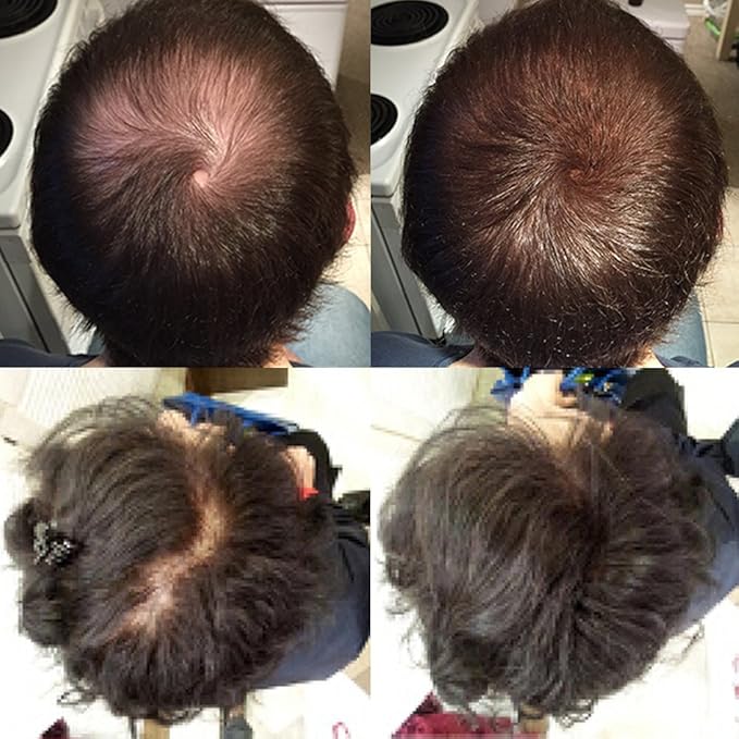 Keratin Hair Building Fibers: Hair Fiber Filler and Thickener for Men and Women - Cover Up and Concealer for Thinning Areas or Minor Bald Spot - Thicker, Fuller Hair in Seconds - 25 grams, Grey