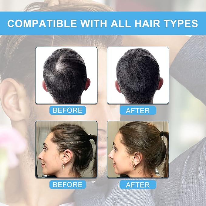 Hair Building Fibers for Thinning Hair with Spray Applicator Pump Nozzle - Natural & Undetectable,Instantly Thicker Fuller Hair Conceals Hair Loss 30 Sec,4 Shades for Men & Women,27.5g (Medium Brown)