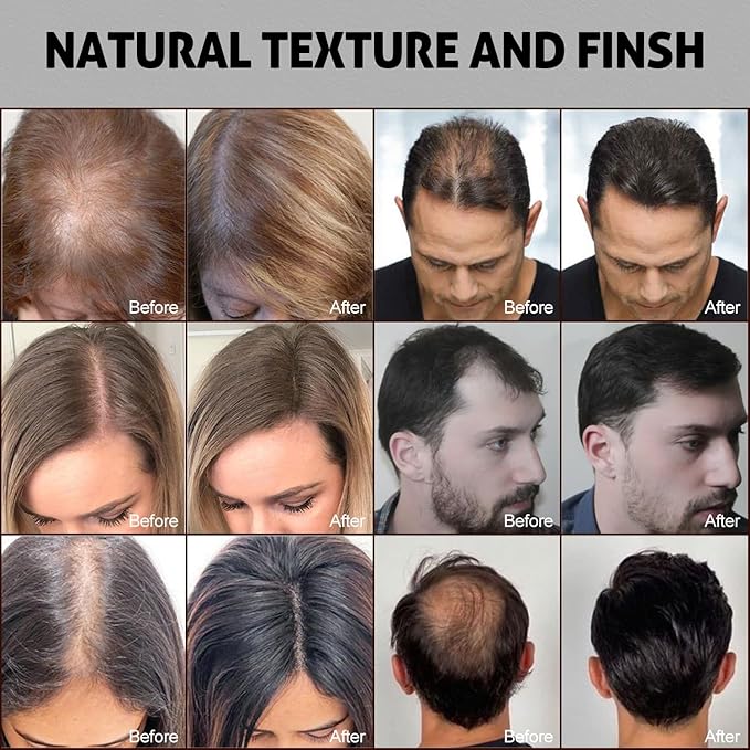 Ustar Hair Building Fibers for Thinning Hair 12g Conceals Hair Loss Instantly Thicker Fuller Natural Look 9 Shades for Women & Men (Medium Blonde)
