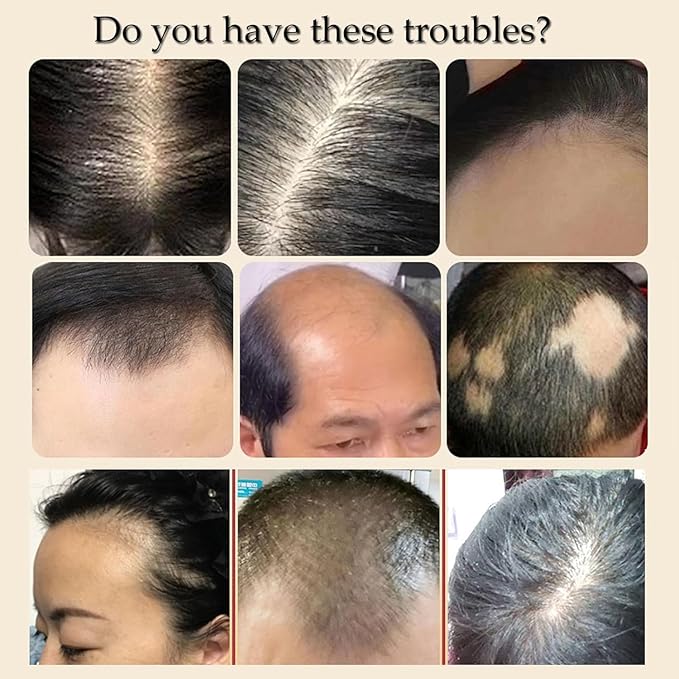 Yaopin Anti-Hair Loss and Hair Growth Solution, Yao Products Herbal Hair Care Serum 30ml/1.05oz (3 Pcs)