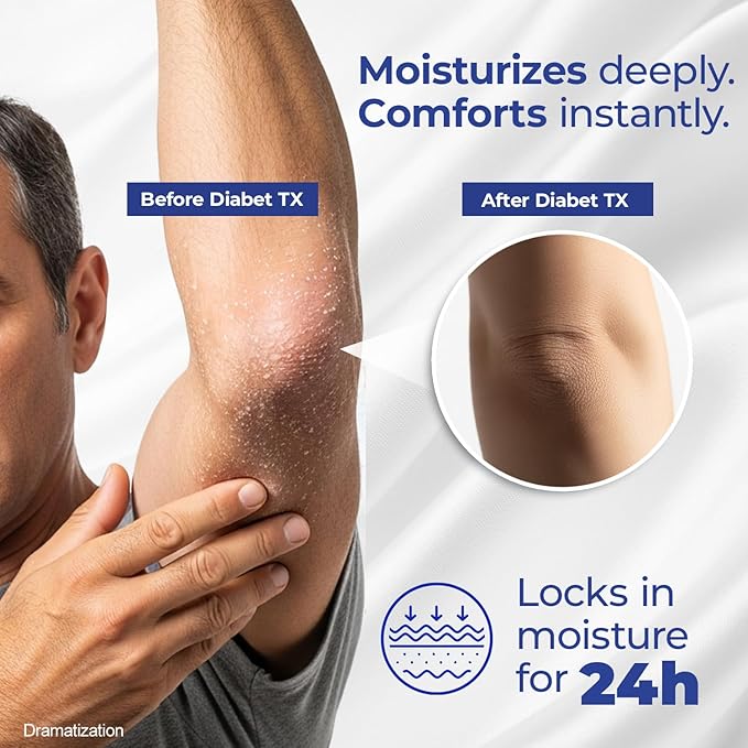 Goicoechea Diabet TX Diabetic Lotion with Urea for Dry Skin | Soothing Hydrating Cream with Aloe, Oatmeal & Vitamin E for Hands, Elbows, Feet & Body | Extra Dry Skin Support, 13.5 Oz | 1-Pack