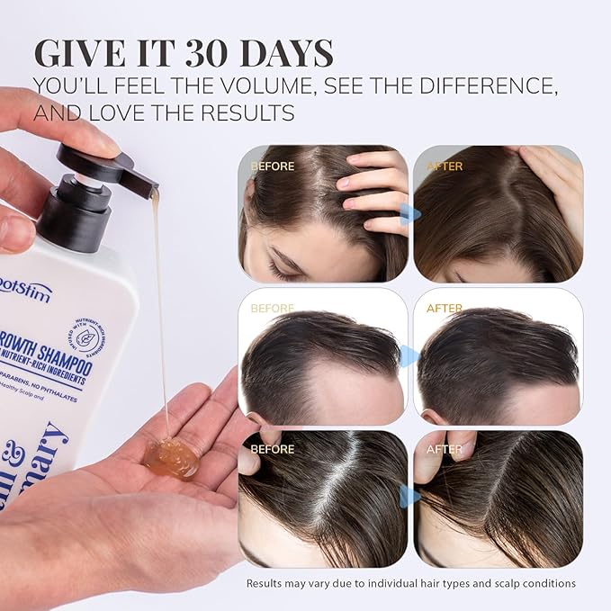 Biotin & Rosemary Shampoo for Hair Growth: Hair Loss Shampoo for Thinning Hair Infused with Nutrient Rich Ingredients for Hair thickening Sulfate Free 16.9 fl oz