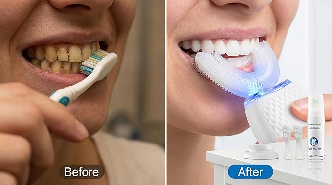 U-Shaped Electric Toothbrush for Adults, Hands-Free Auto Teeth Cleaner with 360° Ultrasonic & Foam Mousse, 4 Brush Heads, LED Light & Charging Base Kit (White)