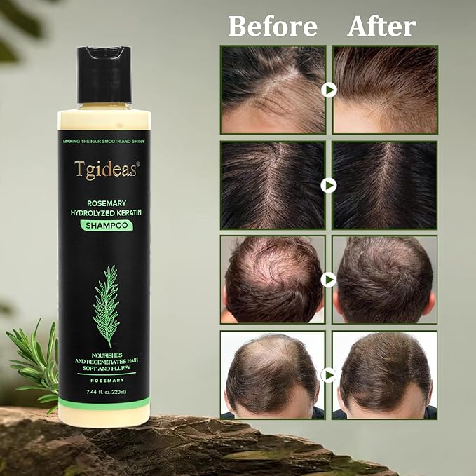 Organic Rosemary Hair Growth Shampoo for Women and Men-Natural Thickening & Strengthening Shampoo with Hydrolyzed Keratin for Thinning Hair & Hair Loss 7.4 fl.oz - 2 Packs