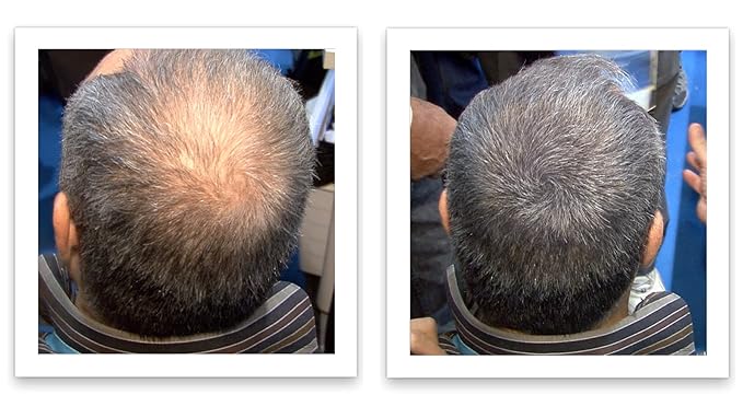 Caboki Hair Building Fiber + Built-In Spray Applicator (30-50 days supply). Salt & Pepper Light