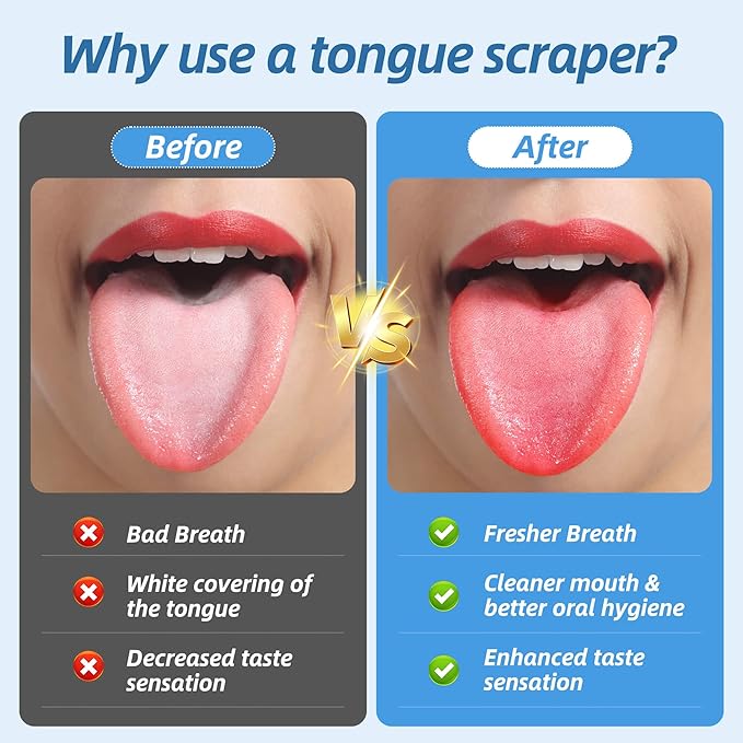 6 Pack U-Shaped Tongue Scrapers - Reusable & Easy to Clean Tongue Scrubber with Travel Case for Adults & Kids - Medical-Grade 100% Stainless Steel Tongue Cleaner for Fresh Breath & Oral Care