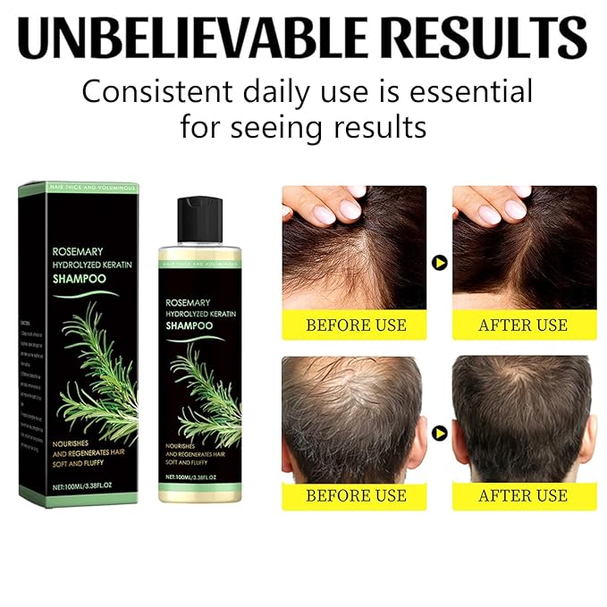 Rosemary Hair Growth Shampoo, Large Capacity Hydrolyzed Keratin Shampoo, Natural Thickening & Strengthening for Hair & Hair Growth (200 ML)