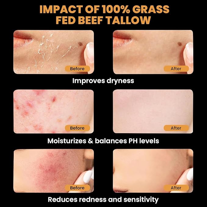 MONIER Tallow and Honey Balm for Face, Beef Tallow for Skin, Moisturizer with 100% Organic Grass-Fed Beef Tallow & Raw Wild Honey - Natural Formula for Dry & Sensitive Skin (Unscented)